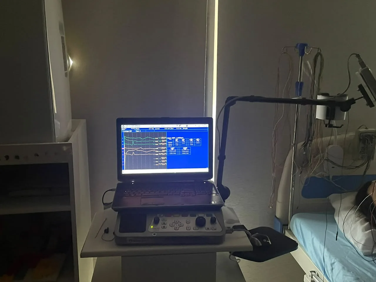 Estudio de potenciales evocados en paciente adulto