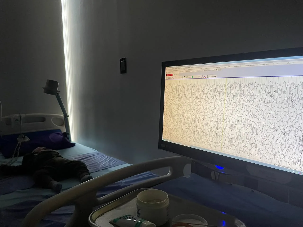 Electroencefalograma en paciente pediátrico