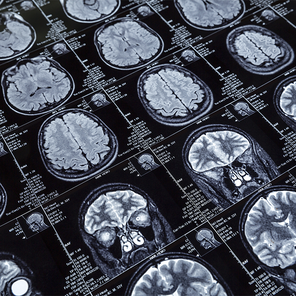 Cuánto cuesta la consulta de un Neurofisiólogo Clínico en Tlalpan CDMX